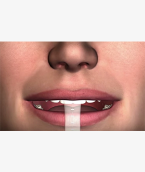 Massad Esthetic Space Ruler (Mesr)/(Pack of 3)